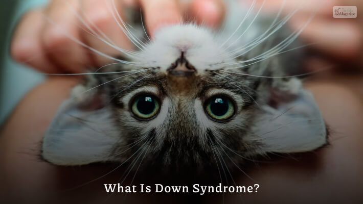 What Is Down Syndrome? 